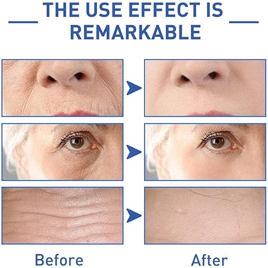 Retinol Caffeine Eye Brightening Cream – Remarkable use effect with Anti-aging eye cream that improves wrinkles, reduces dark circles, puffiness, and fine lines while deeply hydrating and restoring skin’s natural barrier. Formulated with retinol, caffeine, and plant-based ingredients for rejuvenated, youthful-looking eyes.