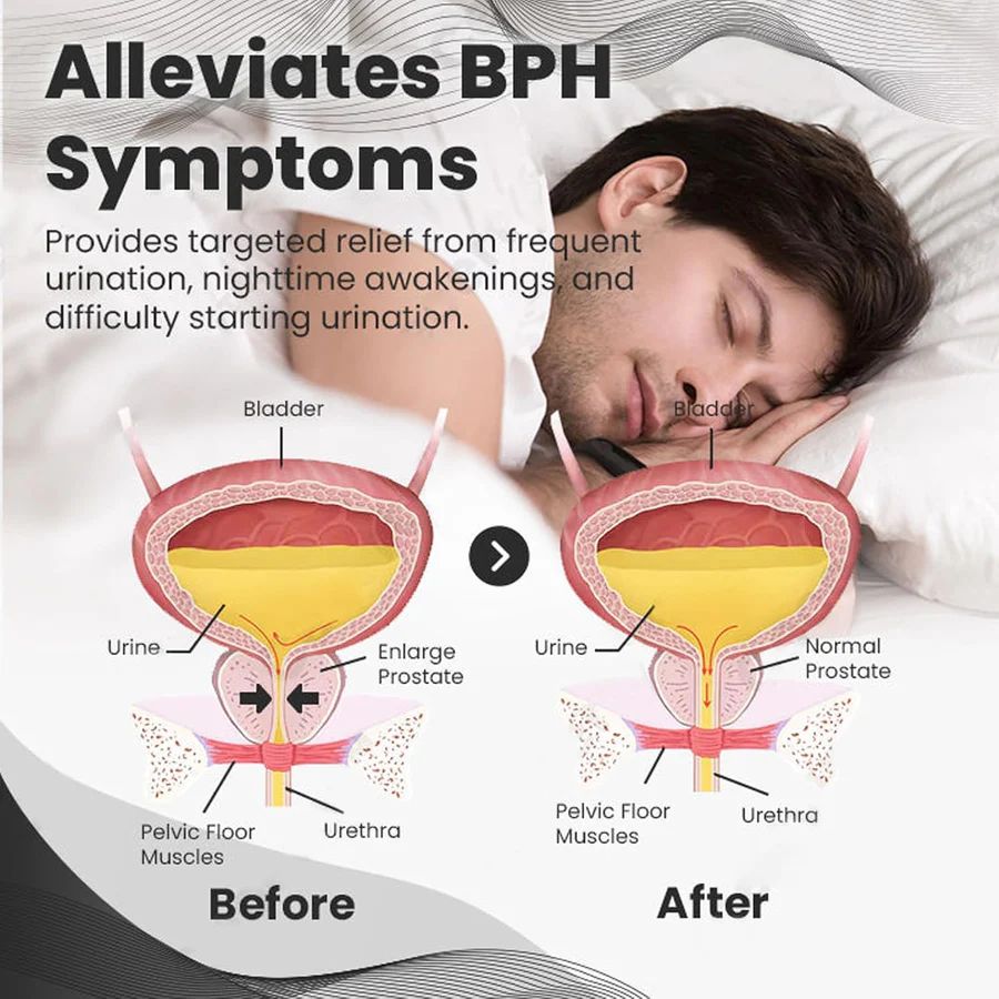 Oveallgo™ BeeBoom Nasal Inhaler BPH symptoms and relief. Experience natural prostate wellness with Oveallgo™ BeeBoom Nasal Inhaler. Formulated with bee venom therapy, this innovative inhaler helps relieve prostate discomfort, improve bladder control, and support better circulation and vitality—a safe, natural solution for men’s health and comfort. 